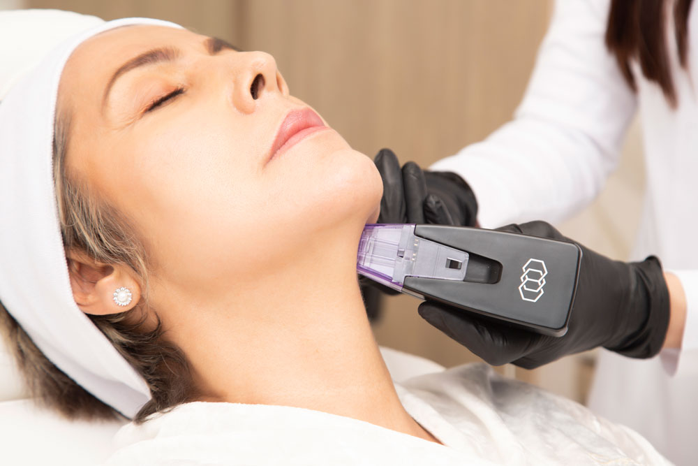 RADIOFRECUENCIA FRACCIONADA — técnica Morpheus