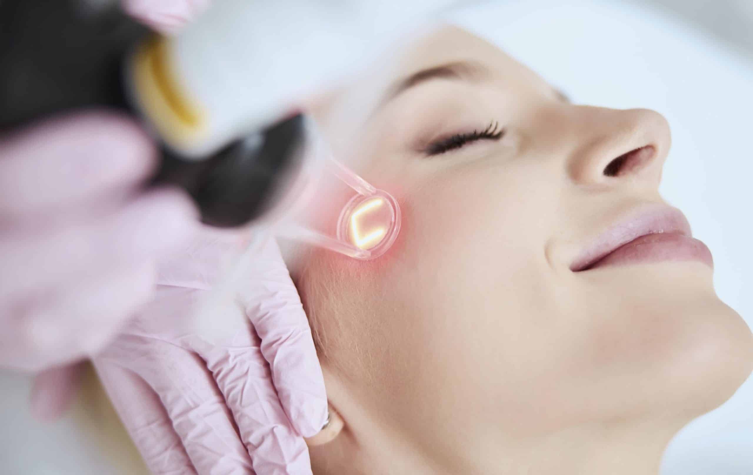 REJUVENECE CON EL láser picosegundo