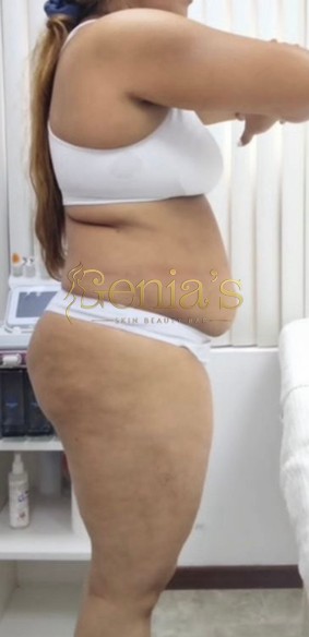 Antes - Caso 1