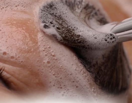 Acne Control Facial