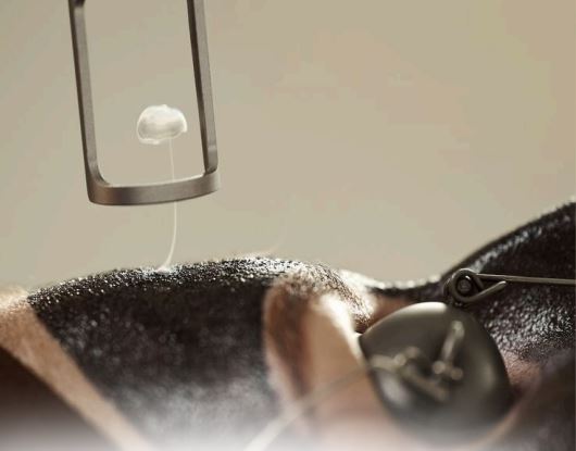 Hollywood Laser Peel