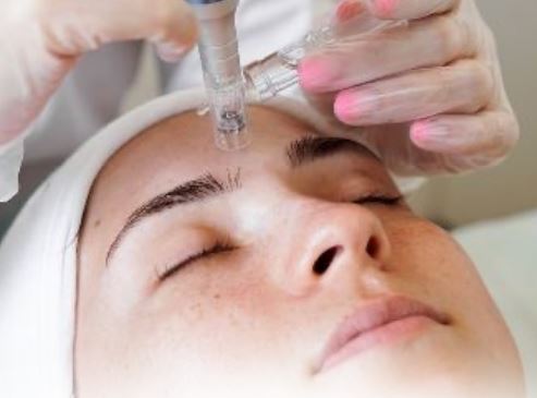 Microneedling Skin Repair