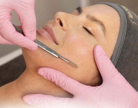 Dermaplaning Facial