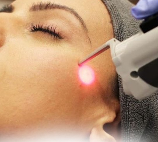 Laser Toning ND:YAG