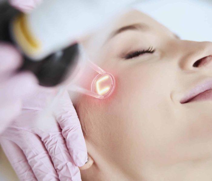 REJUVENECE CON EL láser picosegundo (2)